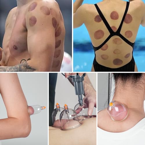 Cupping Therapy Set, 24 Pcs Cupping Set, Professional Cupping Kit for Massage Therapy, Portable Upgrade Cupping with Case, Pump Suction Cups for Cellulite Muscle Pain Relief Physical Therapy - size: 24 CUPS