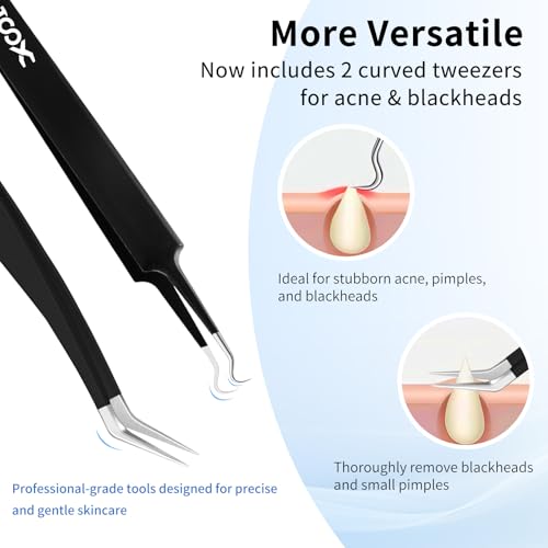 XOOL 10 PCS ESD Precision Tweezers Set, Anti-Static Stainless Steel Tweezers Kit for Electronics, Soldering, Craft, Jewelry, Model Building, Beauty - size: ESD Tweezers 10 PCS