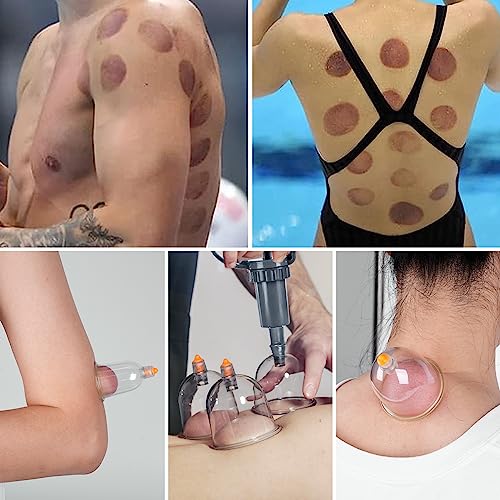 Cupping Therapy Set, 18 Pcs Cupping Set, Professional Cupping Kit for Massage Therapy, Portable Upgrade Cupping with Case, Pump Suction Cups for Cellulite Muscle Pain Relief Physical Therapy. - size: 18 CUPS